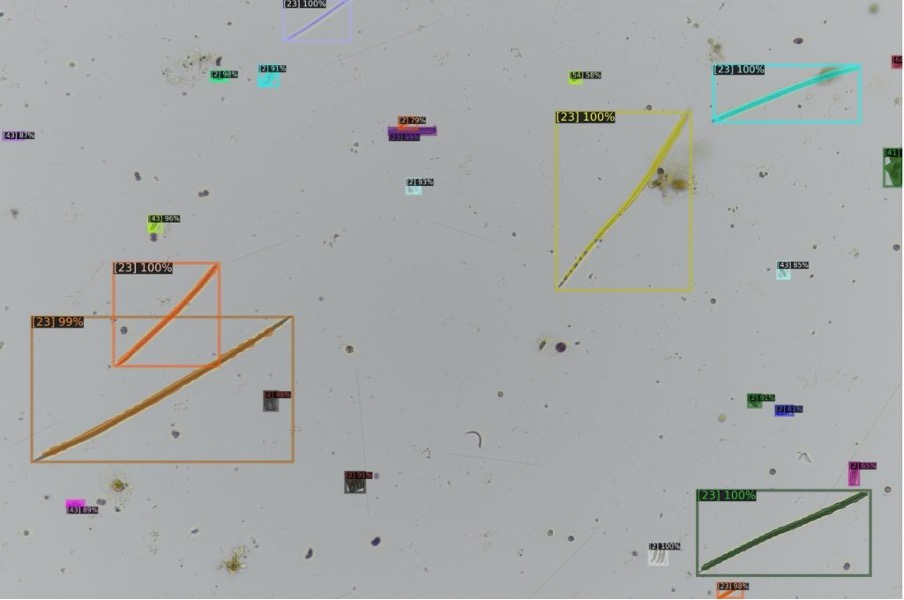 An Example Of A Visualised Algae Detection Result. The Percentage Refers To How Certain The Ai Model Is In Recognizing The Algal Cells